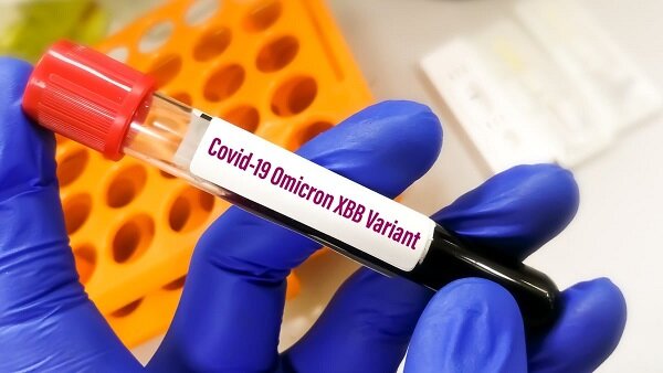از واریانت جدید XBB.1.5 چه میدانیم؟/ «هم ایمنیگریزتر است و هم در انتشار شدیدتر عمل میکند»