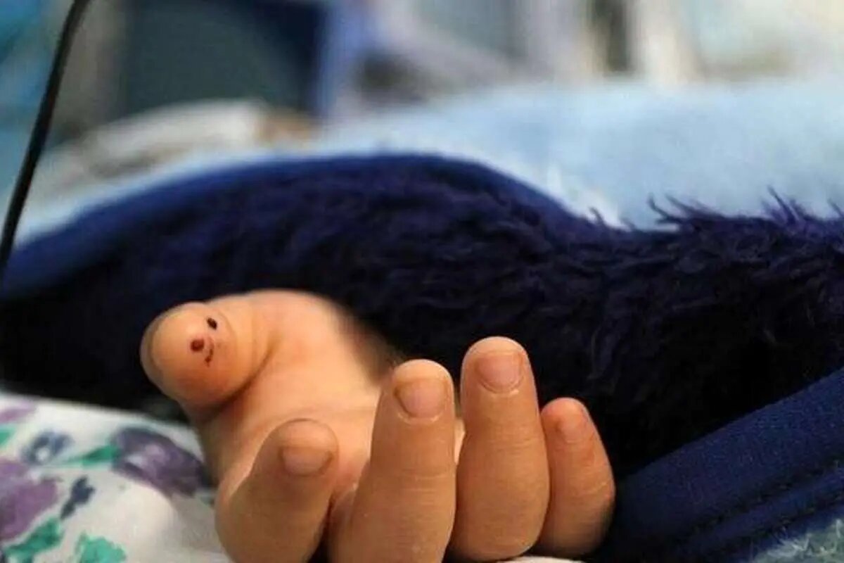 ماجرای مرگ کودک ۴ساله/ خانواده ادعا کردهاند؛ کودک از بالای درخت افتاده، اما کادر درمان از کودک آزاری خبر میدهند ماجرای مرگ کودک ۴ساله/ خانواده ادعا کردهاند؛ کودک از بالای درخت افتاده، اما کادر درمان از کودک آزاری خبر میدهند