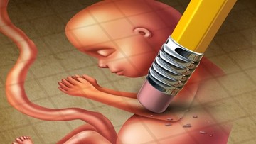 مهم‌ترین دلایل سقط مجدد چیست؟