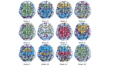 کشف ۱۲ حالت مخفی در مغز