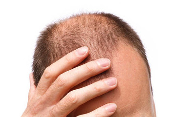 رشد دوباره مو روی پوست آسیب‌دیده