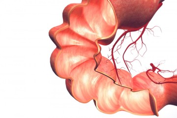 التهاب روده خطر ابتلا به سرطان پروستات را ۵ برابر می‌کند