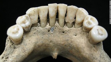 کشف سنگ لاجورد قیمتی در دهان زن ۱۰۰۰ ساله آلمانی/ عکس