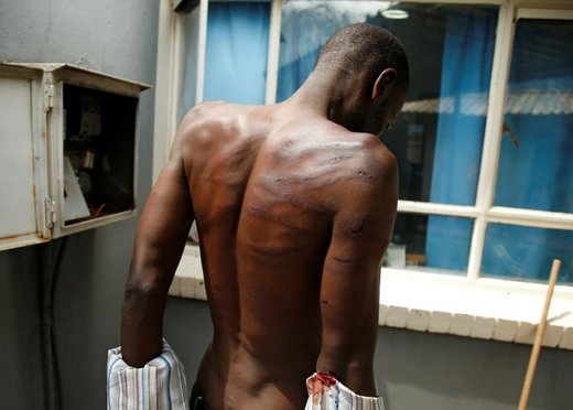 یک مرد زخمی دستگیر شده پس از تظاهرات در بیمارستانی در شهر هراره زیمباوه