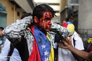 یک کشته و ۱۲ زخمی در درگیری‌های مرزی ونزوئلا