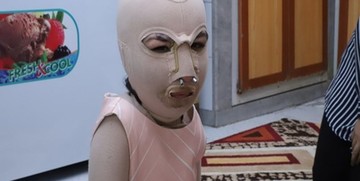 زندگی غم‌بار دختری که پدر و مادرش زنده زنده سوختند/ تصاویر
