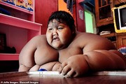 تصاویر | چاق‌ترین کودک جهان، قبل و بعد از ۱۰۶ کیلوگرم کاهش وزن!