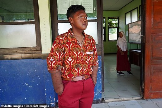 آریا پرمانا، کودک 13 ساله اندونزیایی