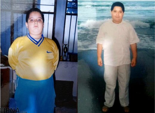 ثبت تازه‌ترین رکورد کاهش وزن جهان توسط جوان گیلانی
