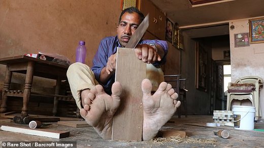 مرد هندی با 28 انگشت