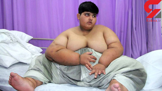 پسر ۱۰ ساله پاکستانی چاق‌ترین کودک جهان