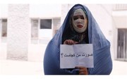 حضور کارگردان فیلم «لانتوری» و جمعی از قربانیان اسید پاشی در صحن مجلس