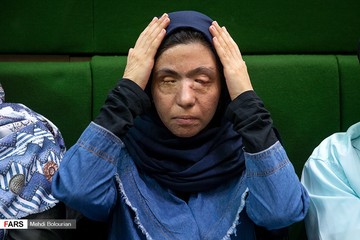 حضور قربانیان اسید پاشی در جلسه علنی مجلس