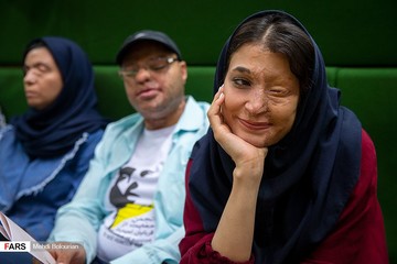 حضور قربانیان اسید پاشی در جلسه علنی مجلس