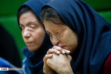 حضور قربانیان اسید پاشی در جلسه علنی مجلس