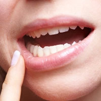 ۷ درمان خانگی برای زخم‌های دهان