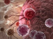 هورمون درمانی سرطان پروستات منجر به چه بیماری خواهد شد؟