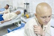 روش جدید درمان سرطان در کشور عملیاتی می‌شود