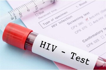 زنانه و جنسی شدن الگوی انتقال ویروس/ آزمایشات ایدز، رایگان و محرمانه است