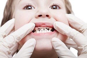 چرا مردم به درمانگران غیرمجاز دندان مراجعه می‌کنند؟