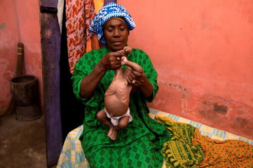 یک زن شفادهنده سنتی 56 ساله، نوزاد   سه ماهه را در شهر زنگبار  تانزانیا ماساژ می دهد