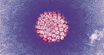 ۱۱ باور غلط درباره HPV؛ بیماری‌ای که باید آن را بهتر بشناسید