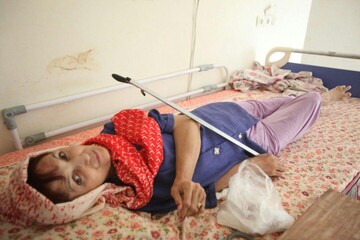 ۴۰ سال جدال نابرابر مرگ با زندگی، سرنوشت یک بیمار مبتلا به 
«FOP»  در شیراز