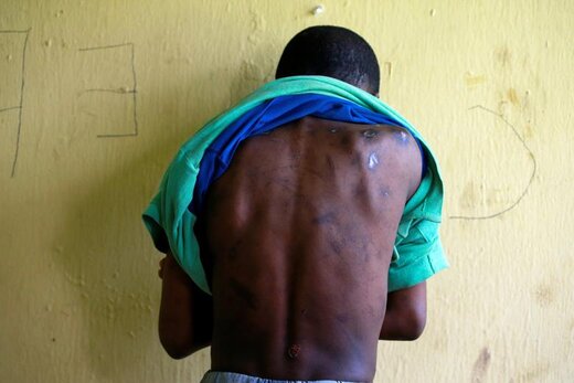 یک پسر 14ساله زخم‌های پشت خود را در اردوگاهی در شهر کادونا نیجریه نشان می‌دهد