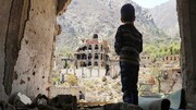 «یمن» چگونه درمان می شود؟