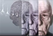 این چربی‌ها خطر ابتلا به آلزایمر را افزایش می‌دهند