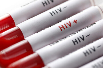 هشدار رییس اداره ایدز وزارت بهداشت: افزایش زنان مبتلا به ایدز در چند سال اخیر