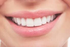 ۵ راه طبیعی برای سفید کردن دندان‌ها