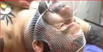 یکی از عاملان ضرب و جرح «هانی کُرده» دستگیر شد