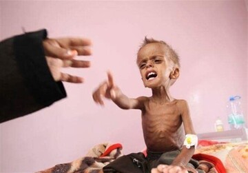 سایه قحطی بار دیگر بر سر یمن افتاد