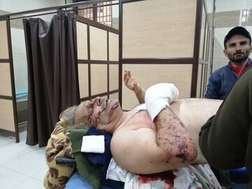 ببینید | فیلمبردار شبکه العالم در حمله تروریستی خان طومان آسیب دید