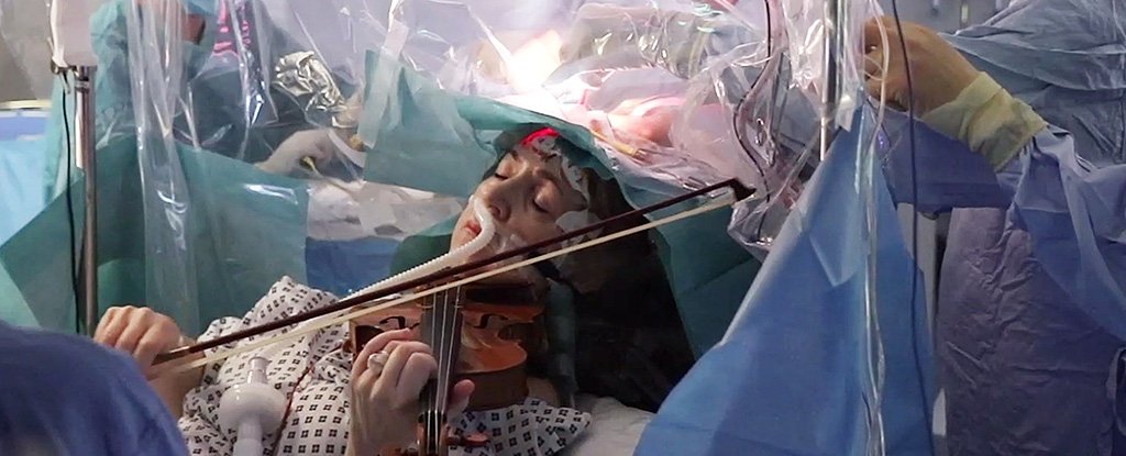 فیلم | جراحی یک تومور مغزی هنگام ویولون زدن