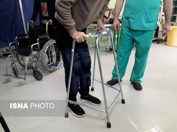  تعویض همزمان ۲ مفصل زانوی بیمار مبتلا به هموفیلی برای اولین بار در شمال غرب کشور