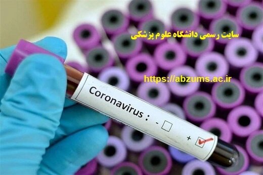 سایت دانشگاه علوم پزشکی تنها مرجع رسمی پیشگیری از ویروس کرونا در استان البرز