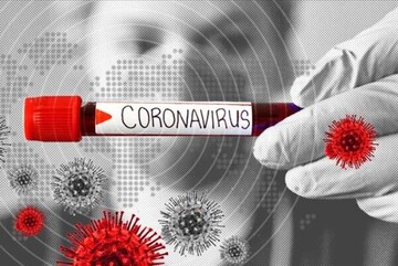 یک آزمایش مثبت کرونا برای زن 55 ساله در ارومیه/ بیمار شرایط پایدار دارد
