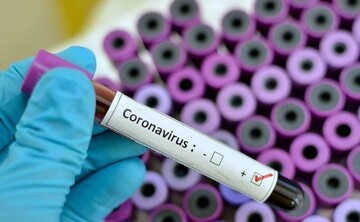 پاسخ به یک سوال؛ کروناویروس توسط انسان ساخته شده است؟