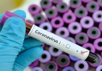 مصرف ویتامین C به پیشگیری از ابتلا به کروناویروس کمک می‌کند؟