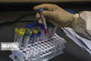 کیت‌های ایرانی تشخیص کرونا وارد بازار شد