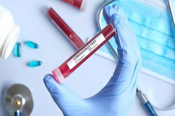 مرگبارترین روز ترکیه از زمان آغاز شیوع کرونا
