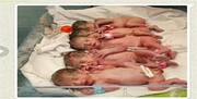 تولد نوزادان ۵ قلو در بیمارستان بی بی حکیمه خاتون گچساران
