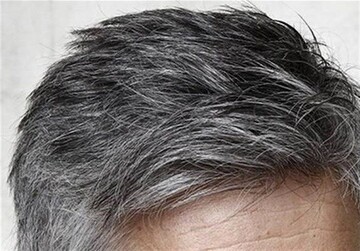 چرا موهایمان زود سفید می‌شود؟ / یک عامل مهم خاکستری شدن مو 