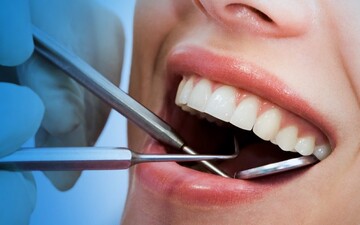 اینفوگرافیک | بایدها و نبایدهای رفتن به دندانپزشکی در دوران کرونا