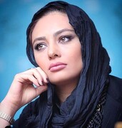 تغییر چهره یکتا ناصر پس از جراحی زیبایی / عکس