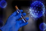 ۷۵ مبتلای جدید به ویروس کرونا در فارس شناسایی شد