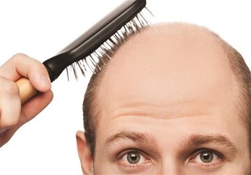 ادعای جدید محققان: احتمال ابتلا به کرونا در افراد طاس بیشتر است
