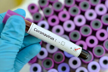 چرا آمار فوتی‌های کرونا در ایران صعودی است؟/ شاید تا دوهفته دیگر اوضاع بهتر شود